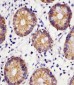 CYK18 Antibody (C-term)